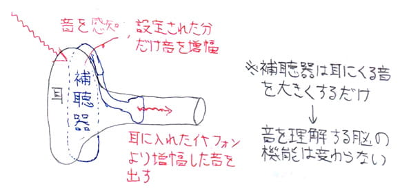 難聴・補聴器について画像02