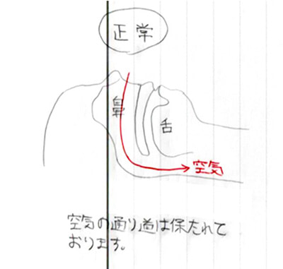 なぜ いびき・無呼吸が起こるの01