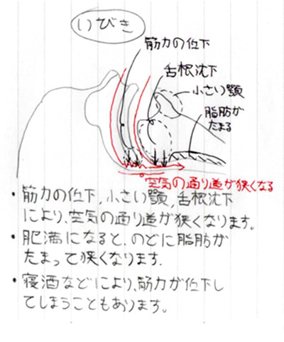 なぜ いびき・無呼吸が起こるの02