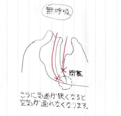 なぜ いびき・無呼吸が起こるの03